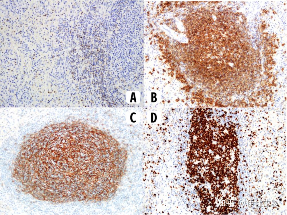 黑热病又名利什曼病,是一种由利什曼原虫感染引起的传染病.