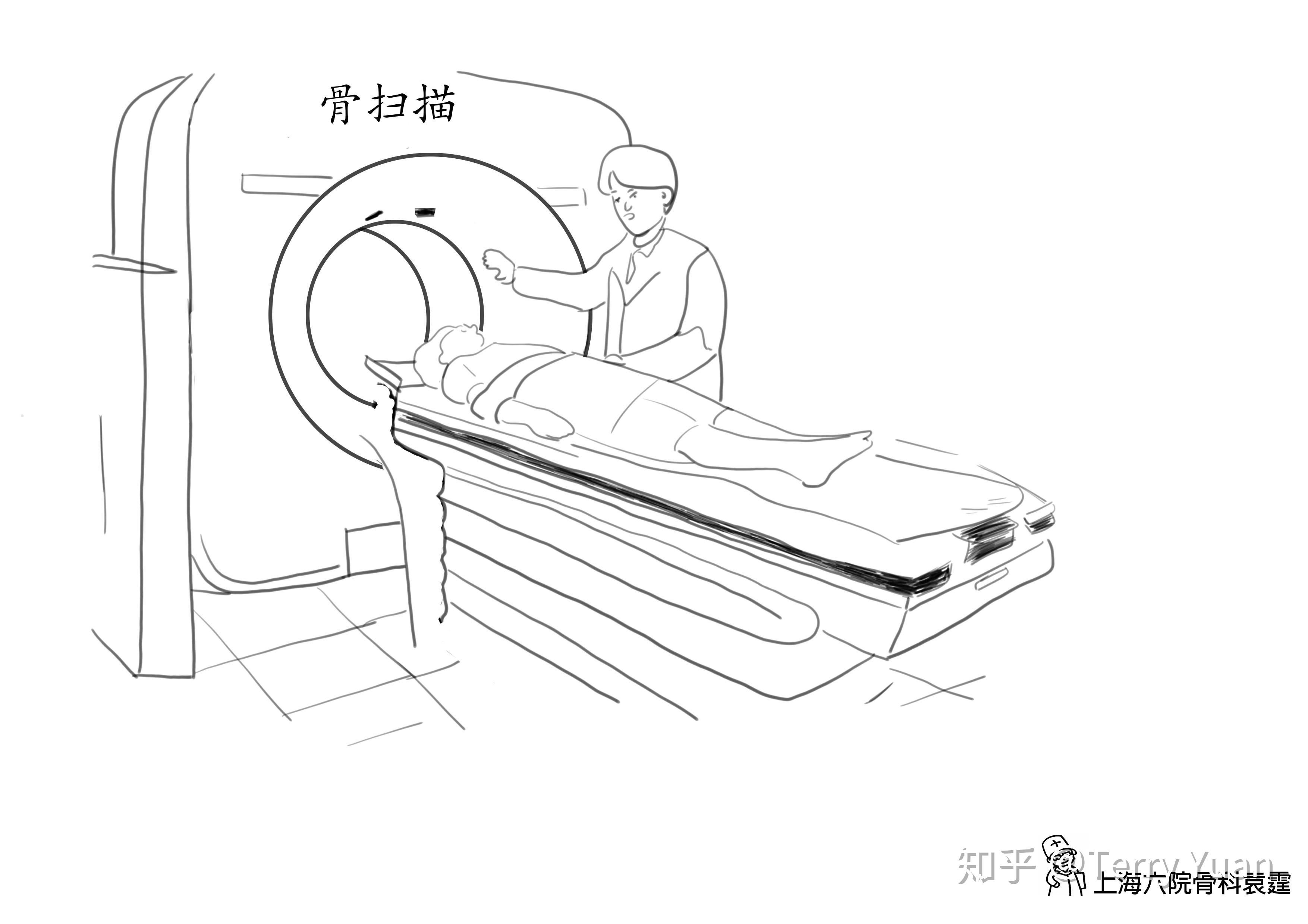 对于骨转移高风险的癌症患者,应坚持每年做1次骨扫描或pet-ct.