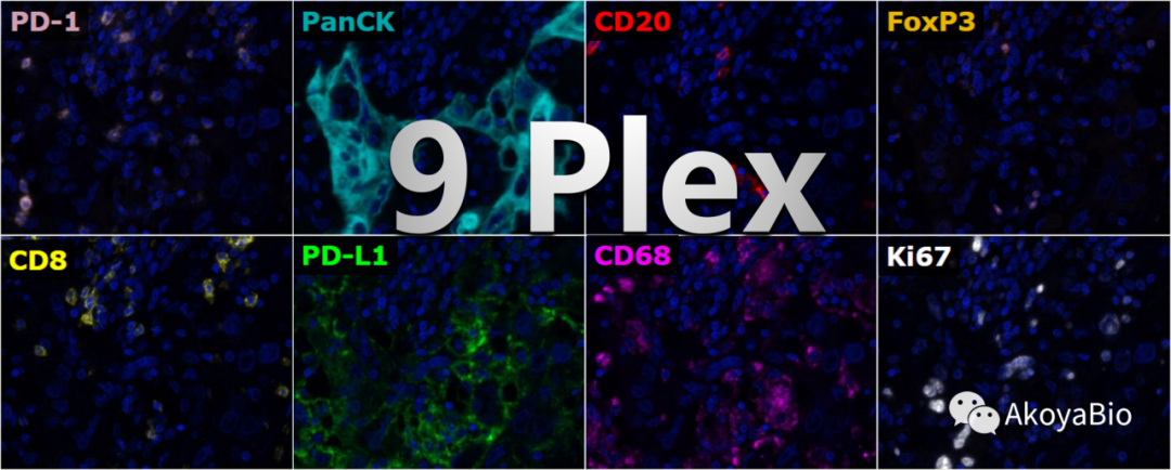 靳姣姣 生物 phenoptics多色免疫荧光组织病理分析方案近年来备受