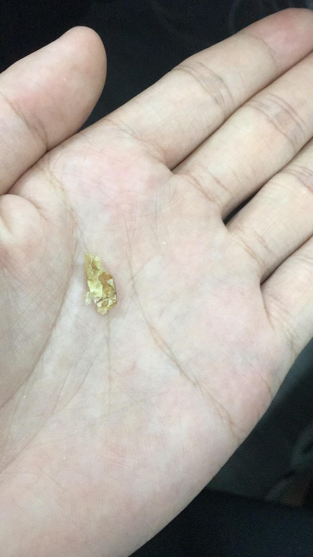 耳屎能大到什么程度? - 知乎