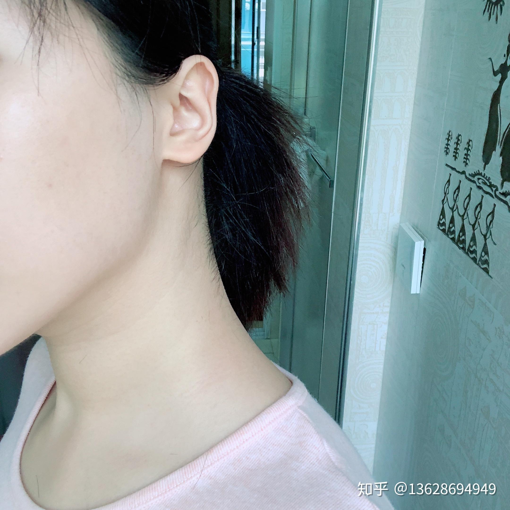 女生鬓角很明显要怎么办