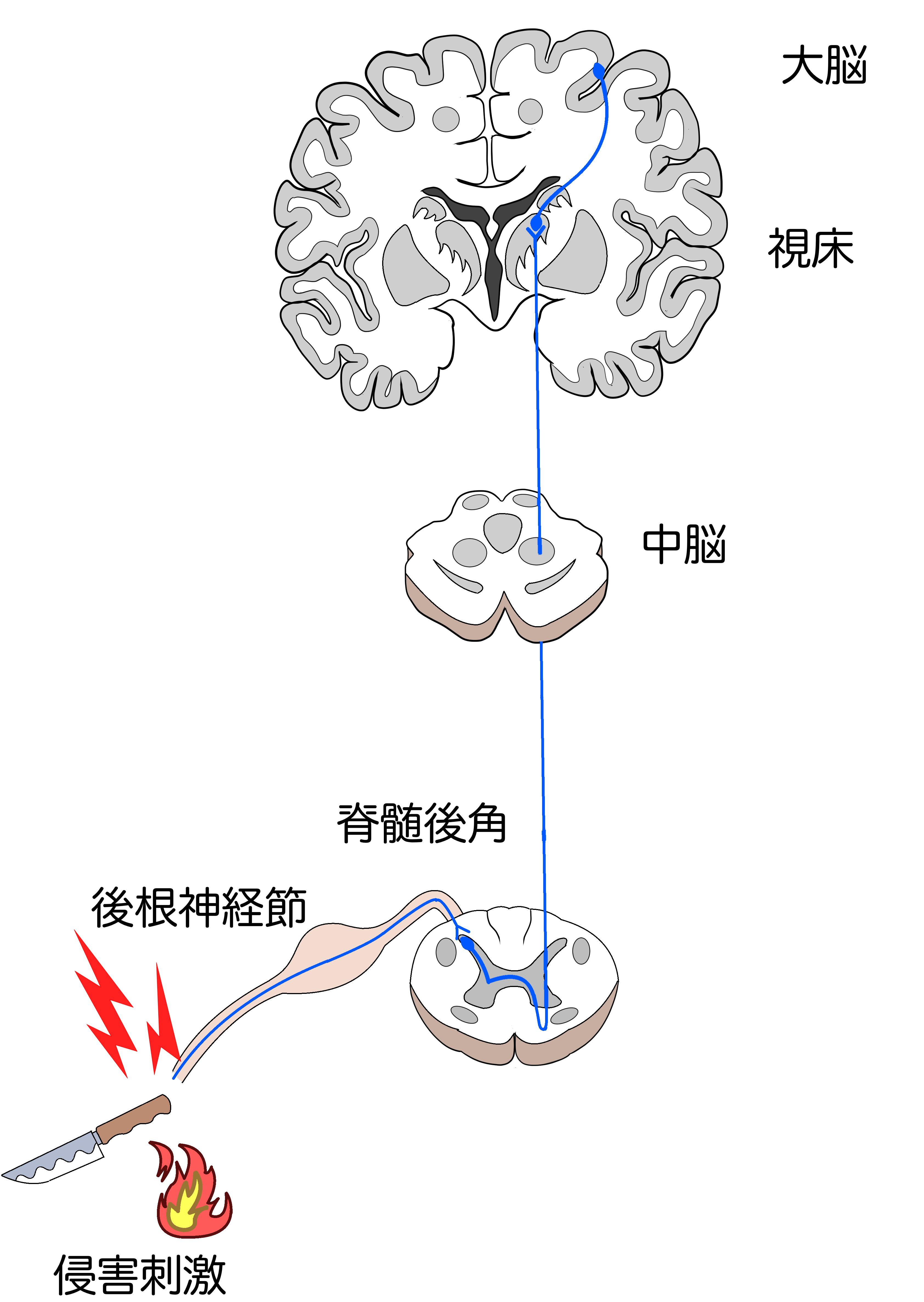 深入浅出|带你认识"熟悉的陌生人"——疼痛