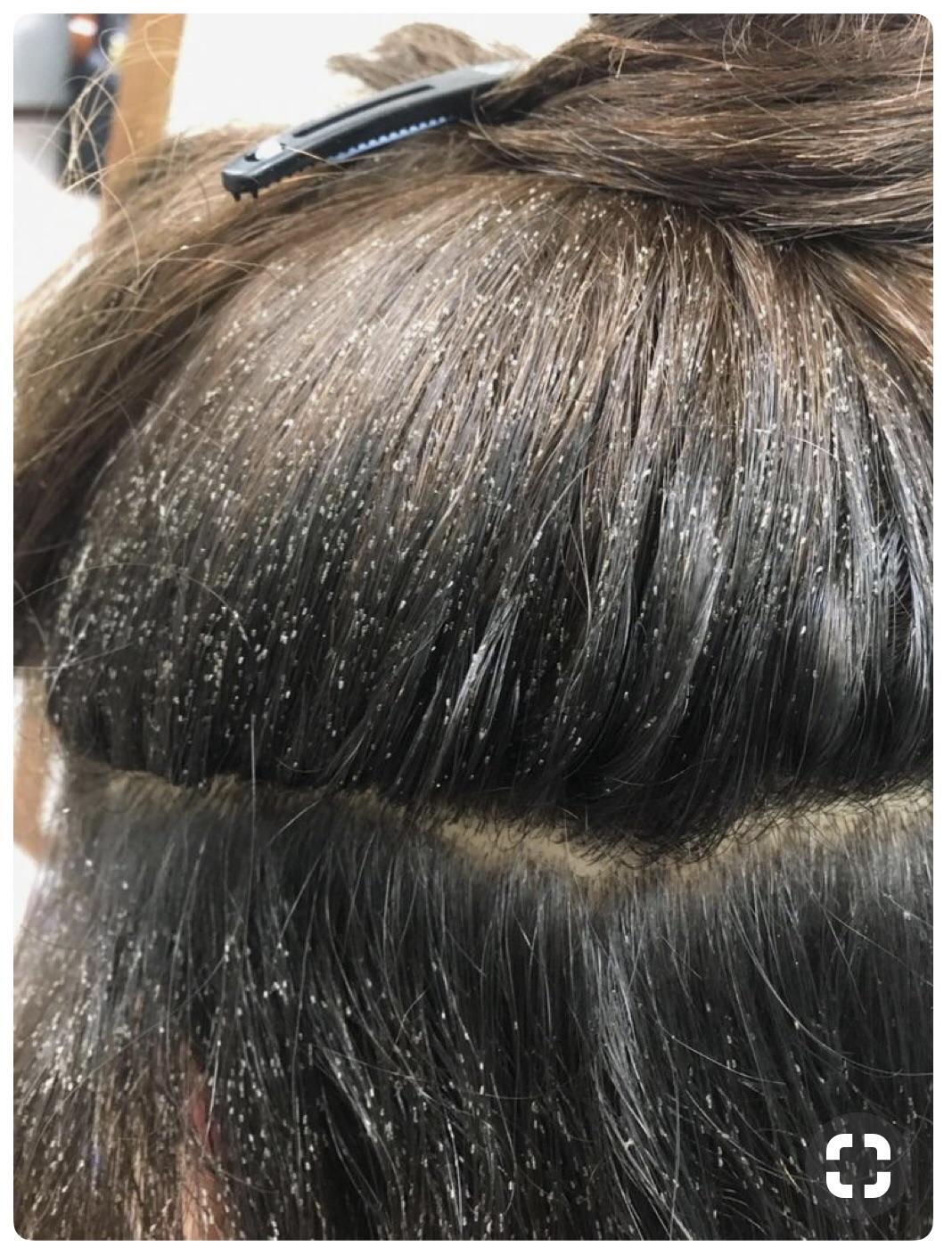 看到头发上有白色管状的类似头皮的东西?