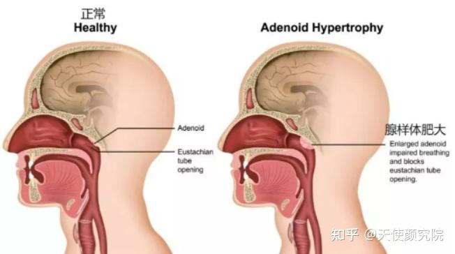 郑秀妍这段太蛊了吧!芒果台怎么能删了不播??!(郑秀妍签约英皇)