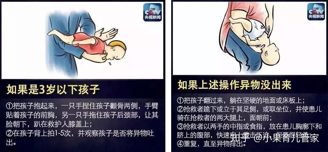 孩子气道堵塞怎么办?烧伤之后怎么做?这5种急救知识要掌握