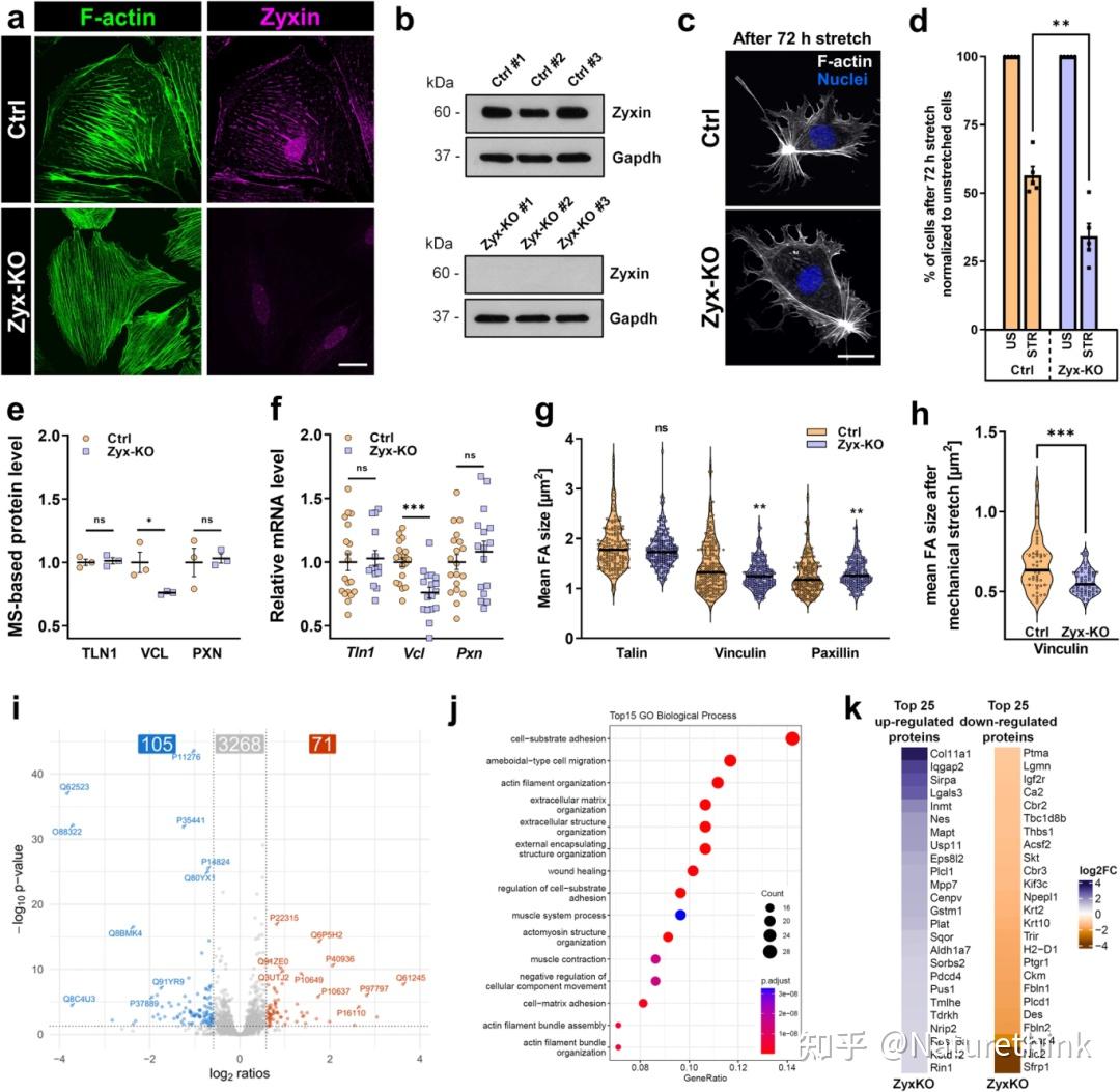 Zyxin 對(duì)足細(xì)胞的穩(wěn)定和功能很重要，尤其是在機(jī)械拉伸期間