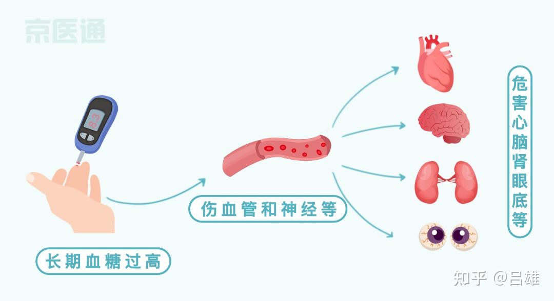 高血压、高血糖、高血脂,三者是什么关系? - 知乎