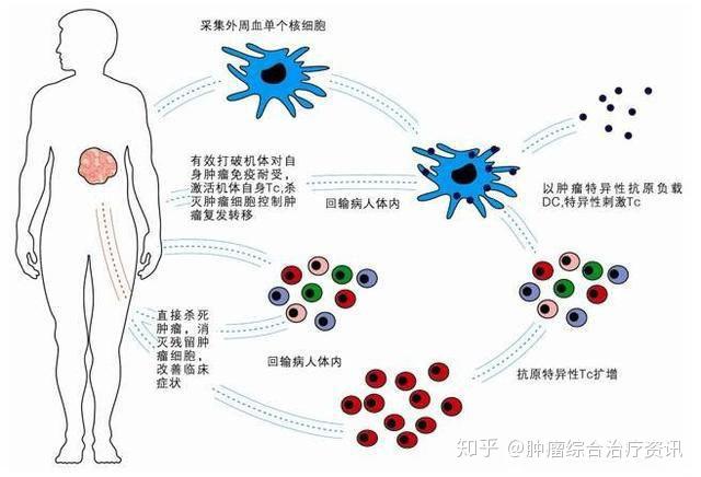 為什麼腫瘤切除之後還會復發或轉移呢