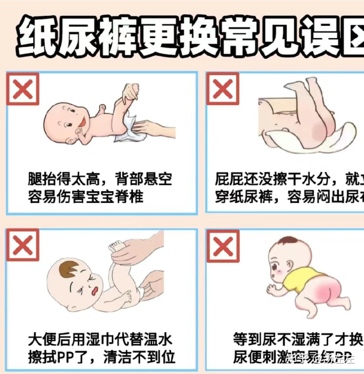 给婴儿换尿布要注意什么?