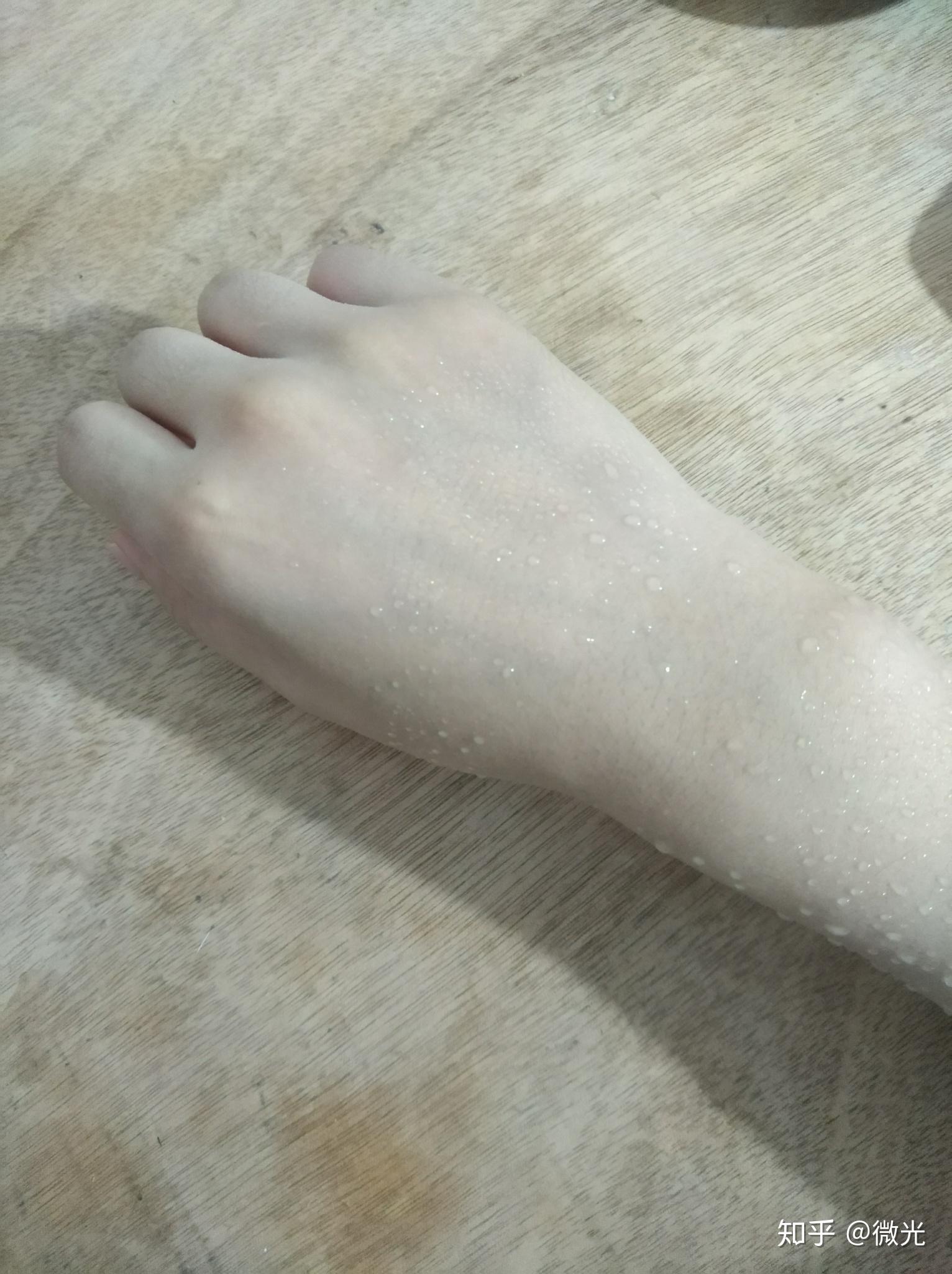 为什么手心出汗手背不出汗