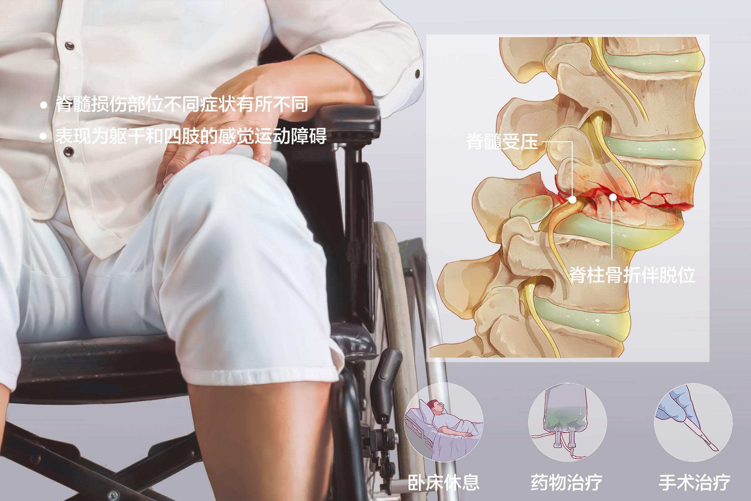 脊髓损伤有哪些症状? - 知乎