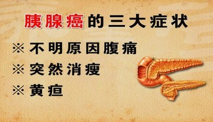 v2-e01bd2704dd310a8ec8b8e71b90366c1_1440w.jpg?source=172ae18b