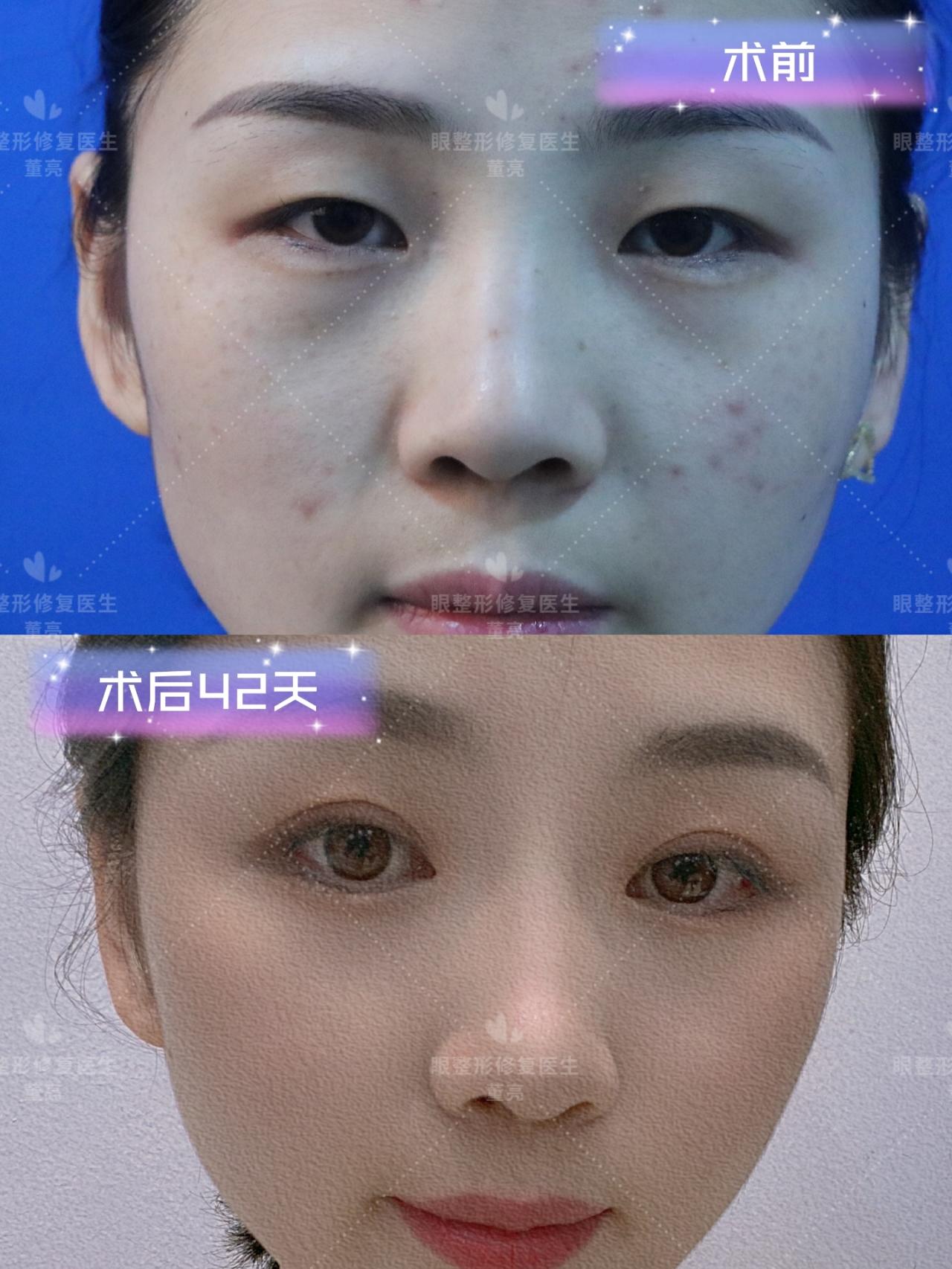 v2-e0425246a13be350855c811cdd0c4104_1440w.jpg?source=172ae18b