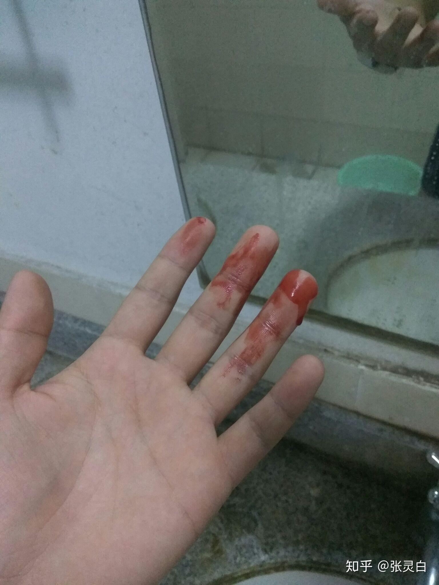 为什么半夜睡觉流鼻血的时候会突然醒来? - 知乎