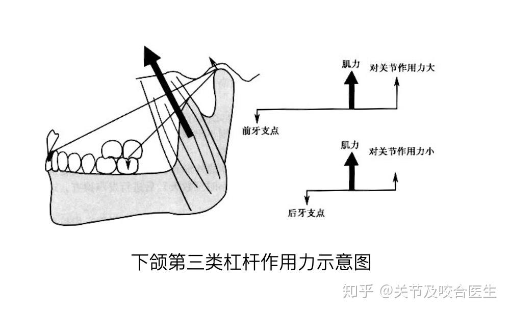 上颌斜导图片