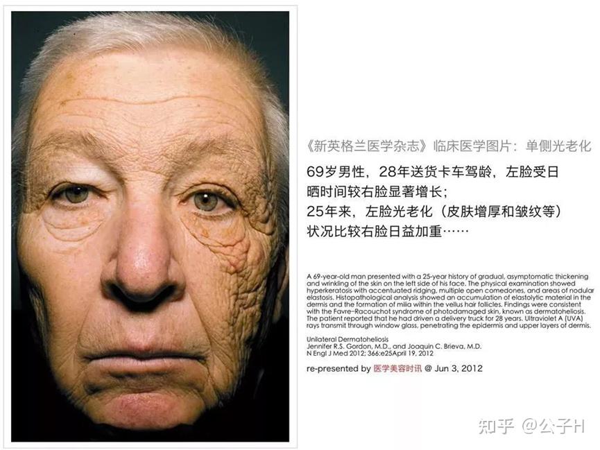 首先,我们来看一张图,据说是英国某货车司机,左右半边脸的神奇而浮夸