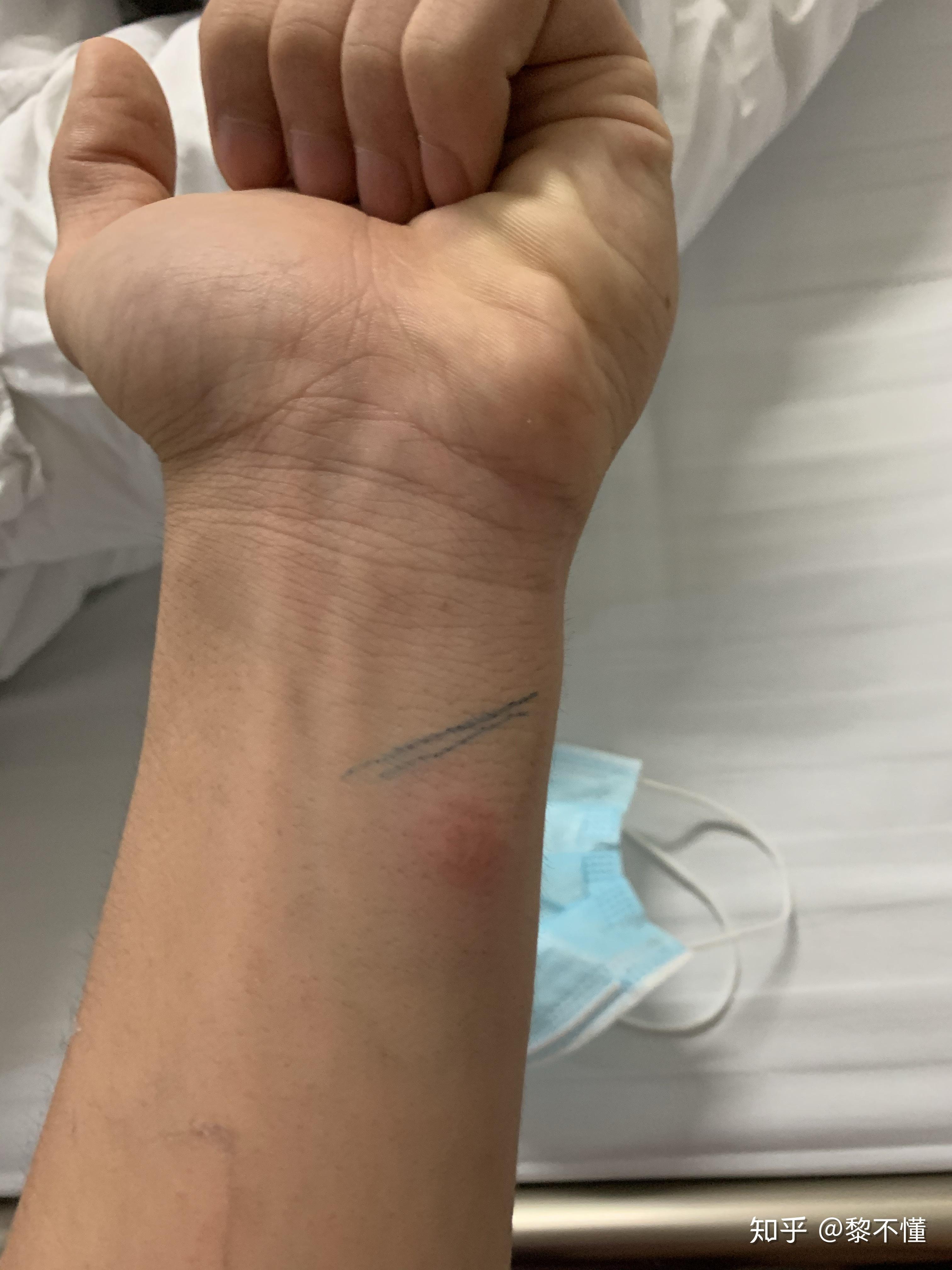 在医院不打针不吃药继续住院了3天,期间做了自费项目550元的肺结核