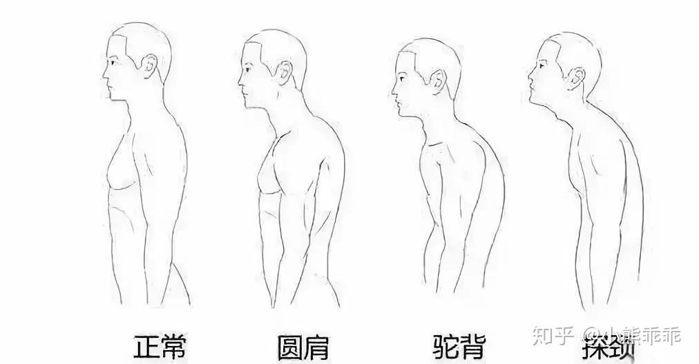 圆肩驼背干货沉肩夹背怎么做