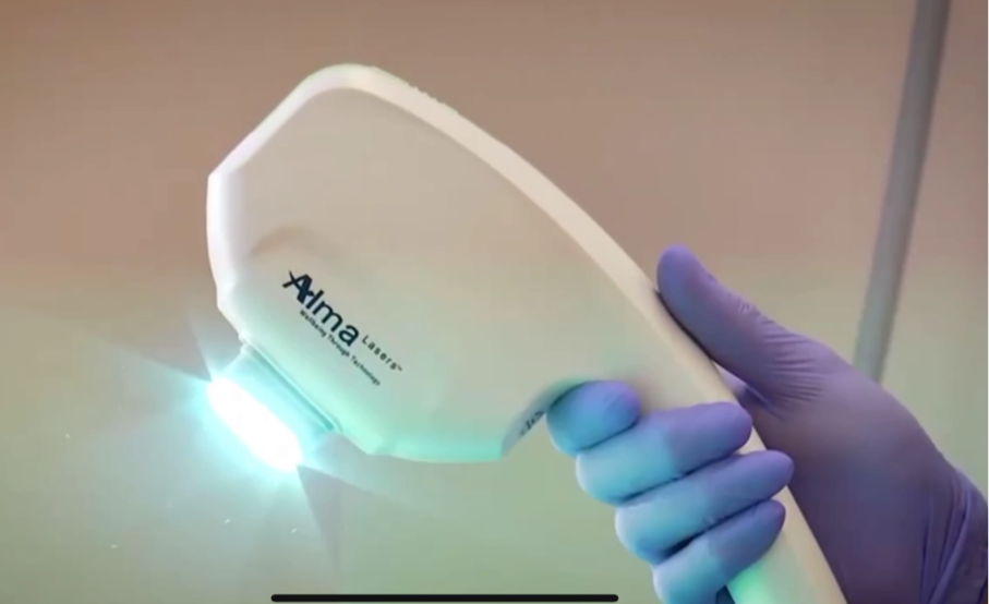 做光子嫩肤会导致皮肤变薄吗？