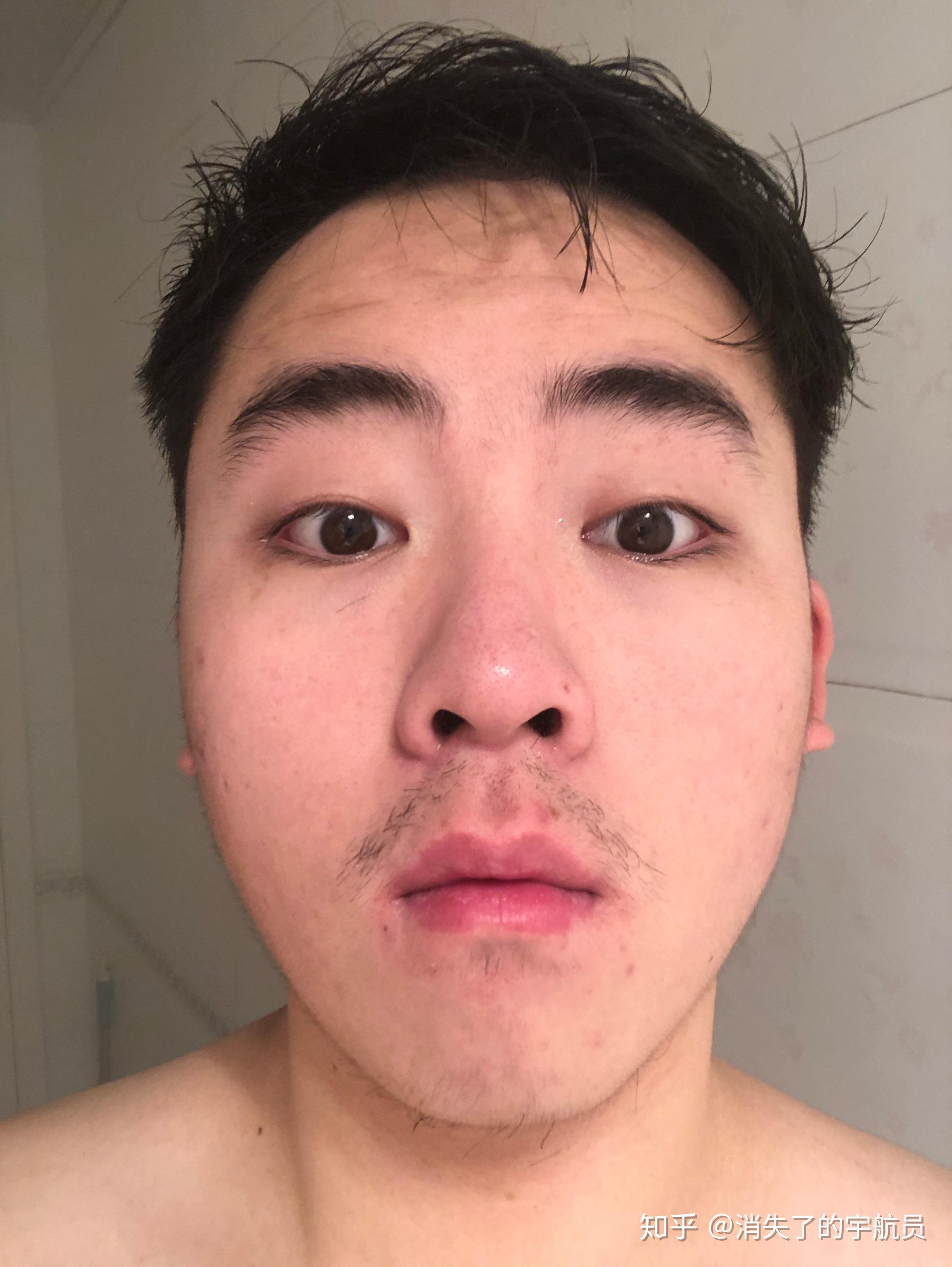厚嘴唇塌鼻子单眼皮的男生还有救吗