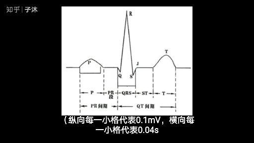 25-奇妙心電圖-如何描述與報告心電向量圖