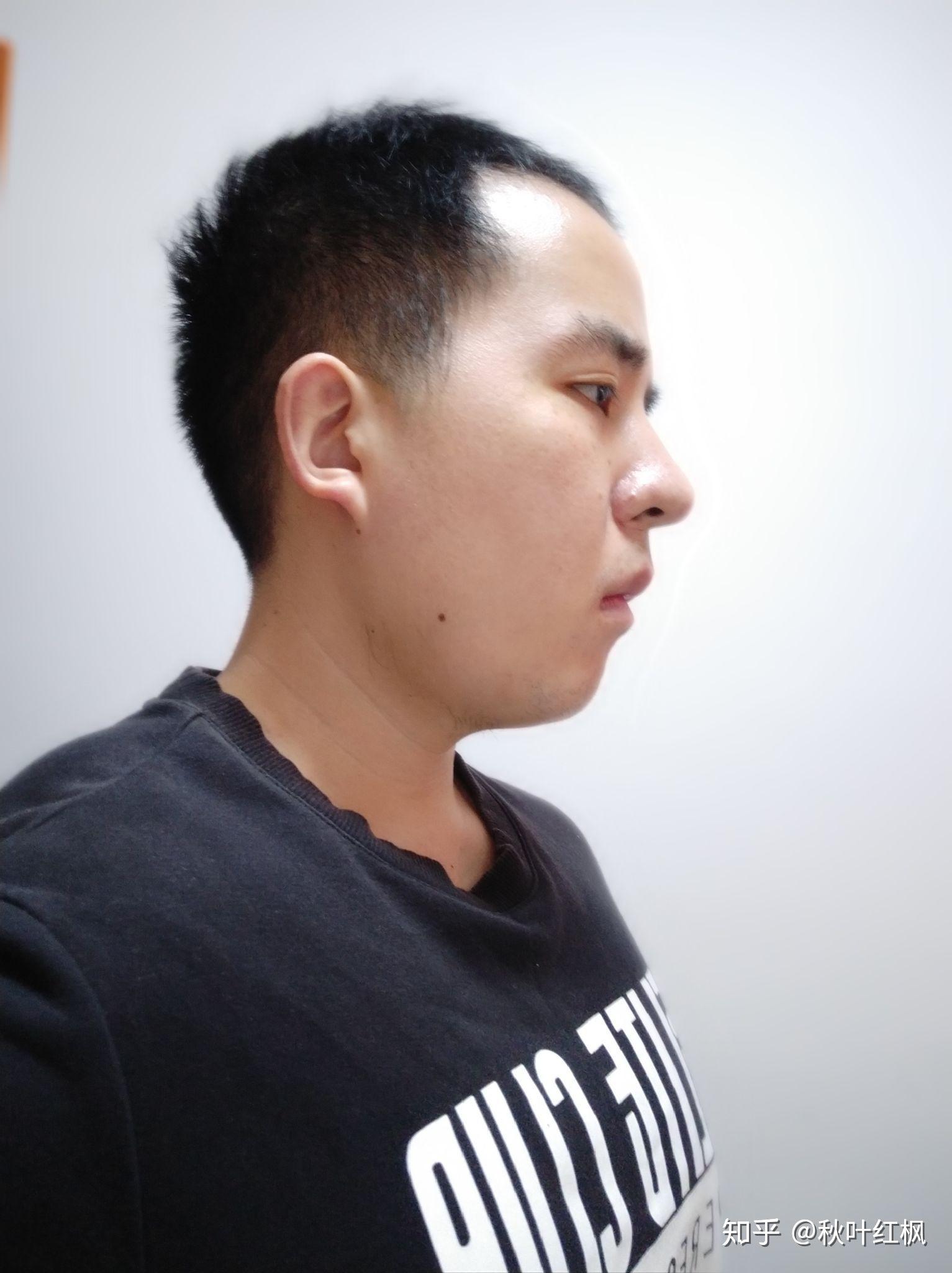 山根高是怎样的一种体验