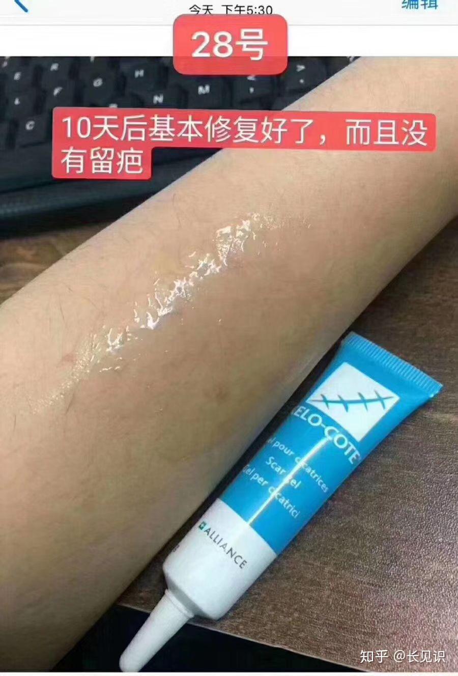 在哪里能买到疤克的正品?