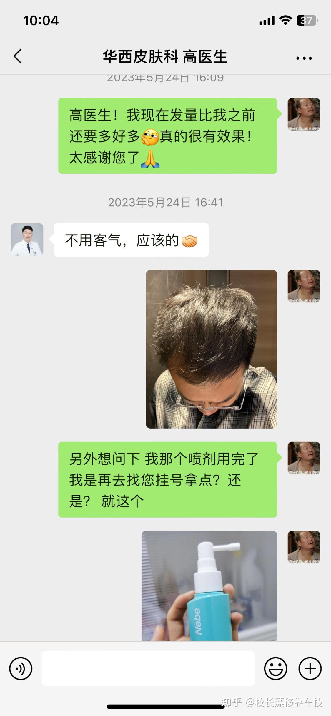什么时候掉头发最厉害 v2-e1af3552a436b73bdacb3e44e745a0dc_r.jpg