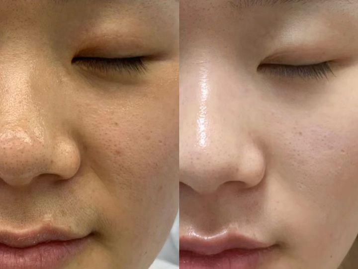 白大褂推荐的美白面霜悠着点用!