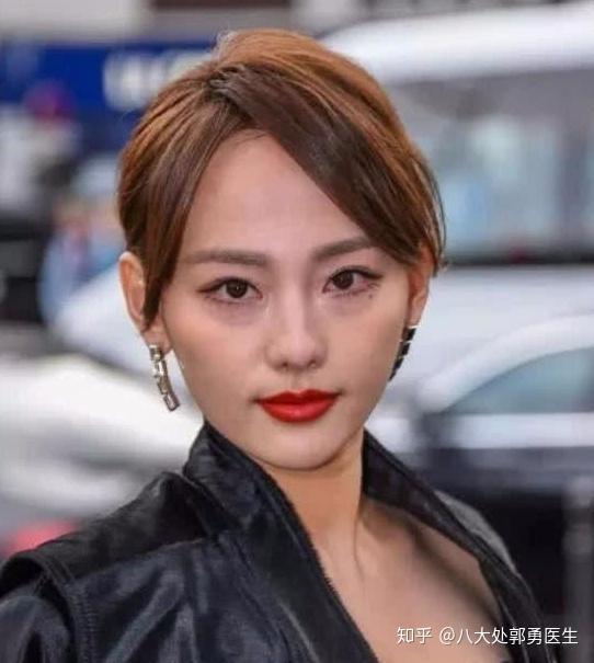 娱乐圈有眼袋的男女明星众多而有人祛除眼袋反而更老了