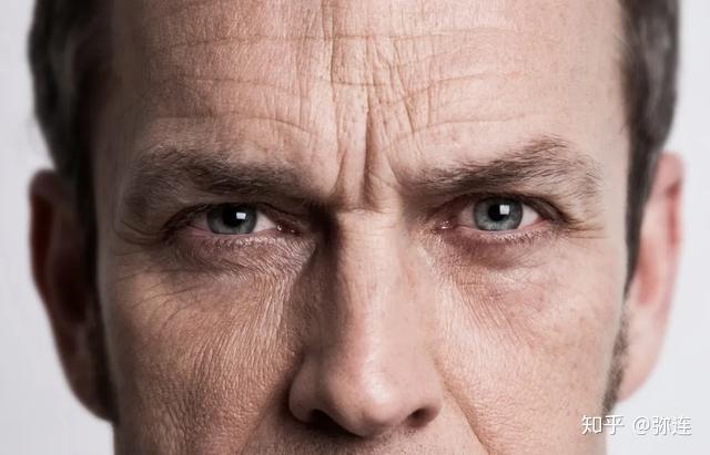 眉间出现川字纹你知道意味着什么吗早看早懂