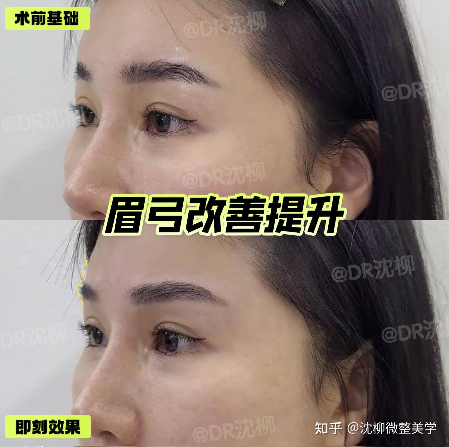 问:怎么通过眉弓塑造高级骨相感呢? - 知乎