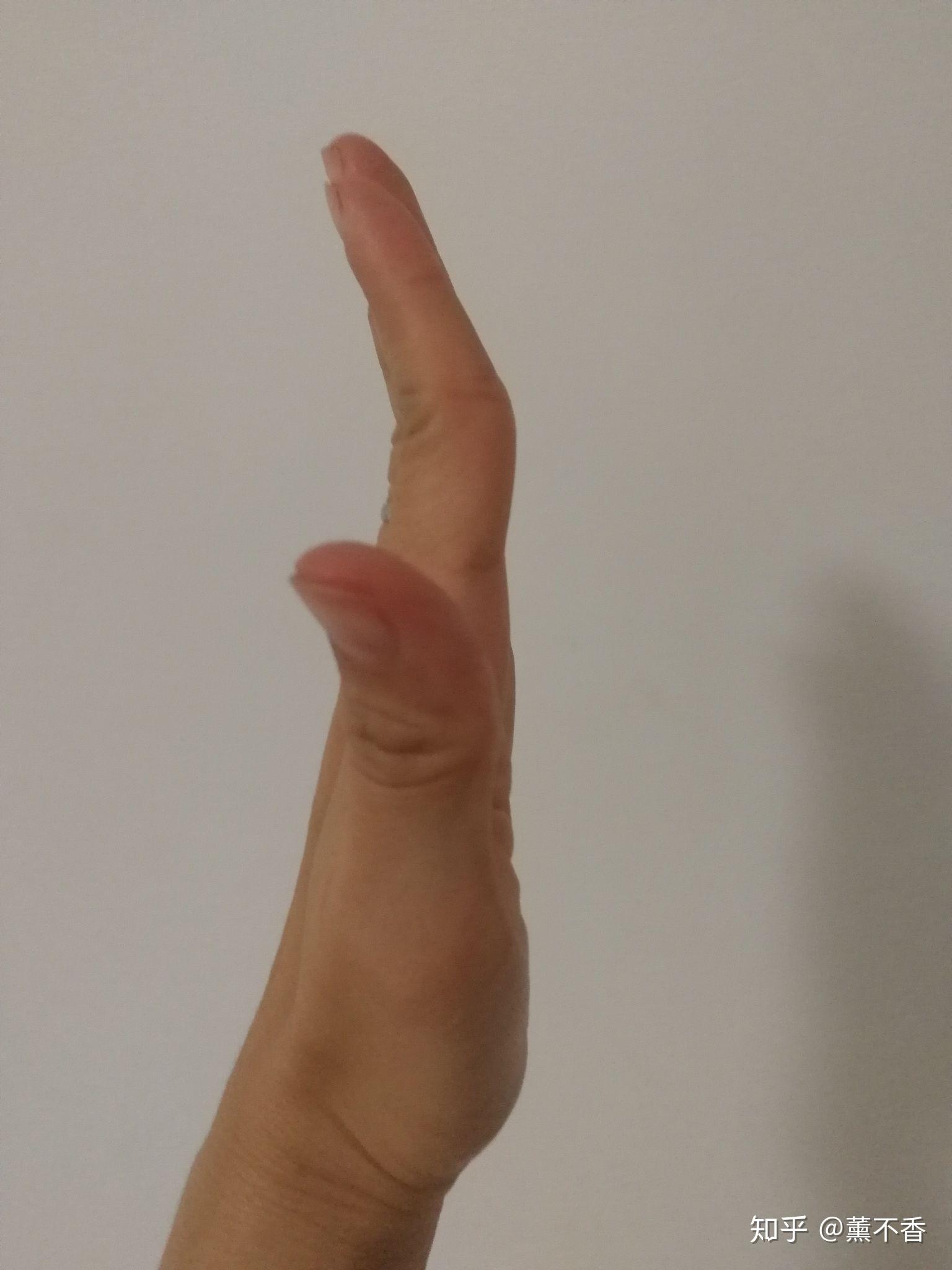 怎么样才能使手指翘起来跳民族舞傣族舞手指不翘太难看了手很直手骨头