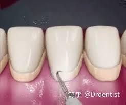 v2-e2058ffc5300b41b36d5f2f2757d9abc_b.jpg