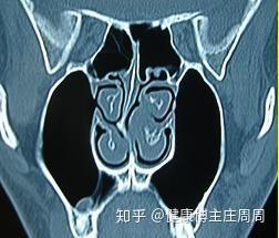 v2-e21f029430a1346db6b1c39e49913bf8_b.jpg