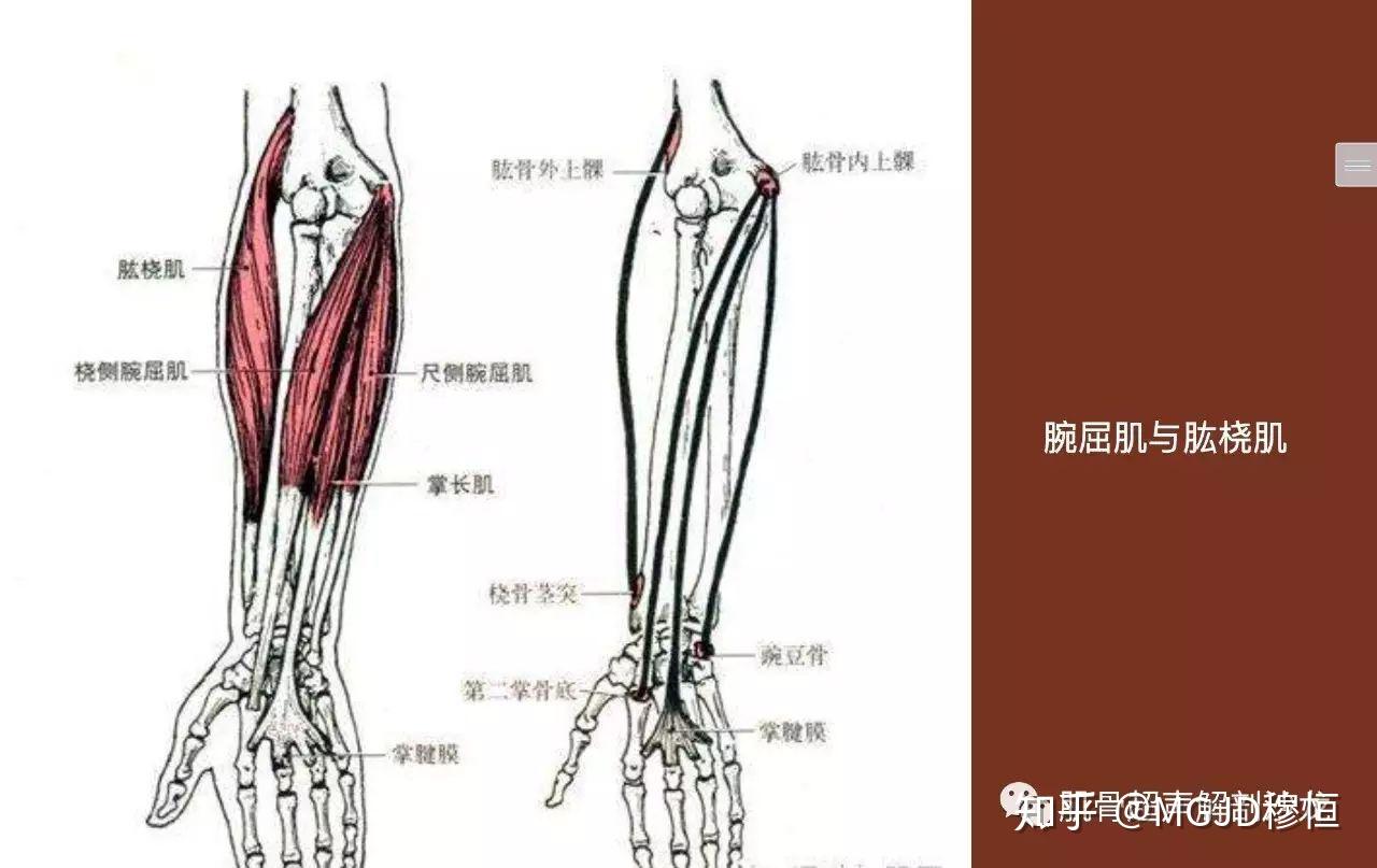 旋前圓肌:兩頭分別起自肱骨內上髁與尺骨冠突,二者之間有正中神經穿過