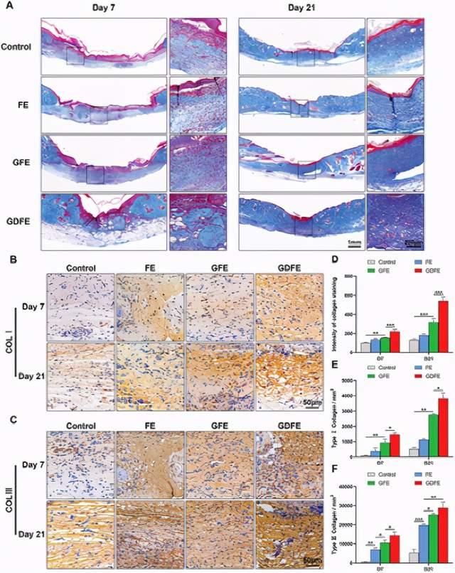 a)在第7天和第21天,有masson三色染色组织的代表性图像.