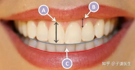 首先了解一下什么样的牙齿标准才是最符合美学的呢?