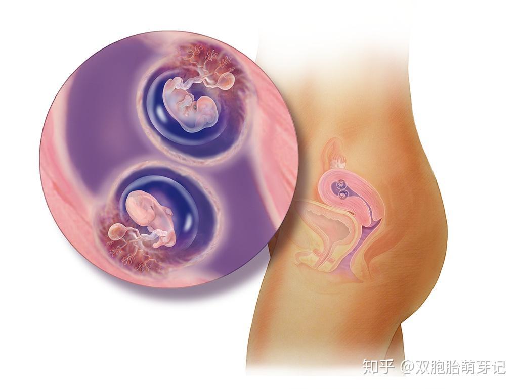组图双胎胎儿发育全过程生命如此神奇妈妈如此不易