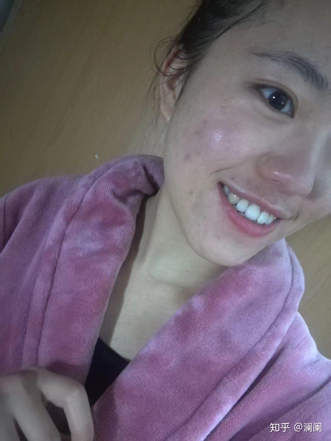 怎么看待五官漂亮但是皮肤差的女性