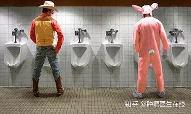 女性膀胱癌症前兆 女性膀胱癌的早期排查 女性膀胱癌图片