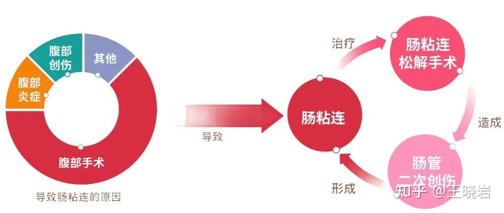 别拖了,肠粘连需要及时治疗 - 知乎