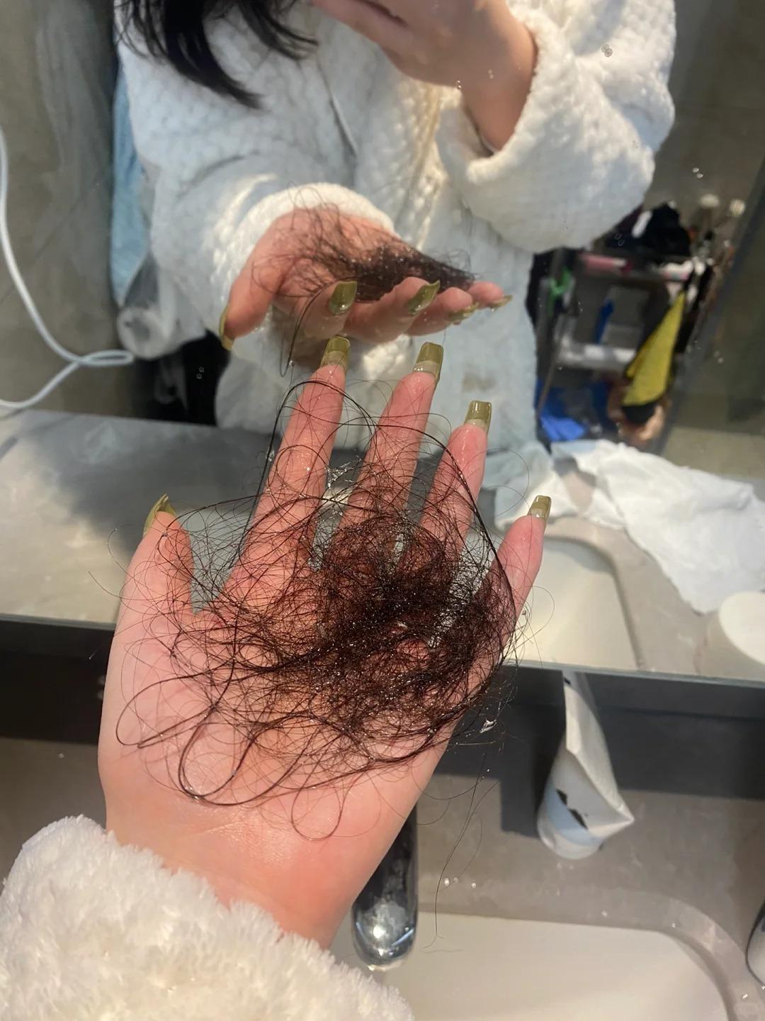 女生脱发很严重该如何解决?