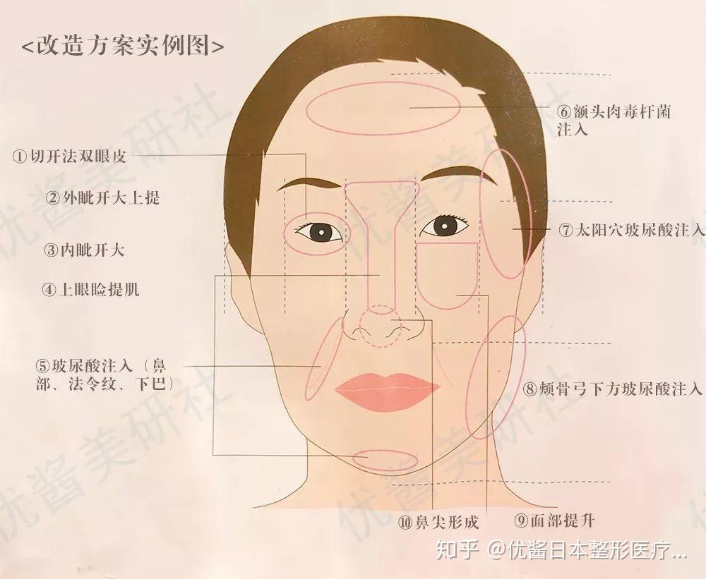 整成好莱坞女星日本技术真的可以做到么日本医美