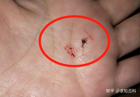 蚊子吸血时为何不偷偷的,反而在我们耳边嗡嗡叫?不怕被打吗? - 知乎
