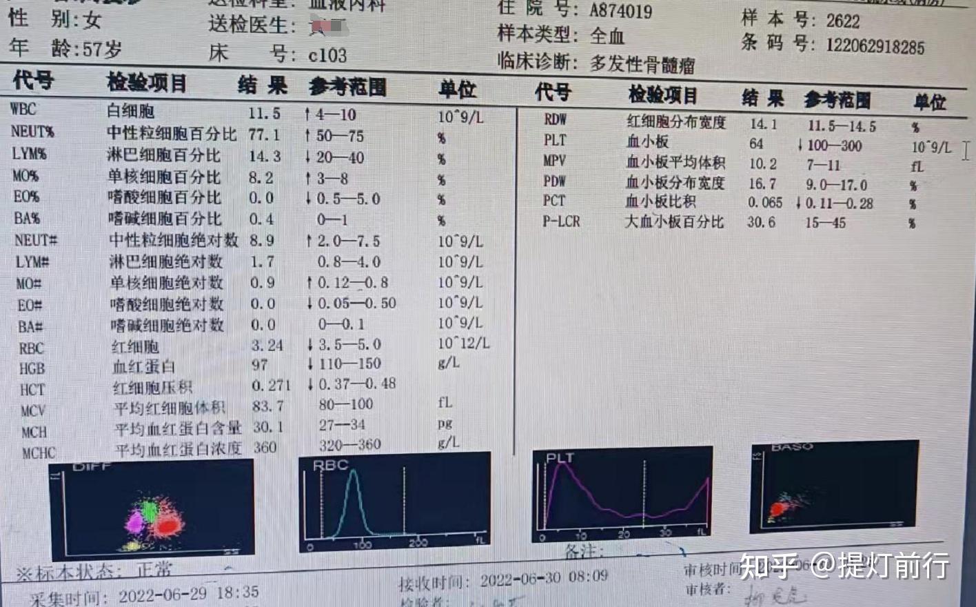 多发性骨髓瘤病理报告图片