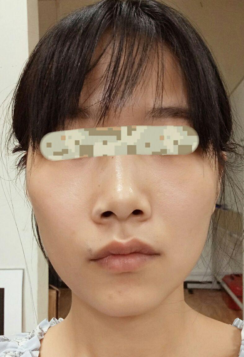 颧骨一大一小 嘴和下巴笑起来是歪的 - 知乎