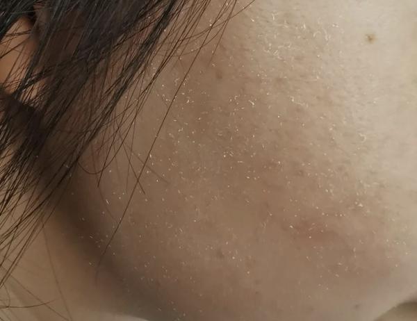 霜成膜（在脸上光滑不黏腻就算成膜）后再化底妆，不然容易搓泥，像这样▶▷防晒霜用洗面奶卸的干净吗？除非