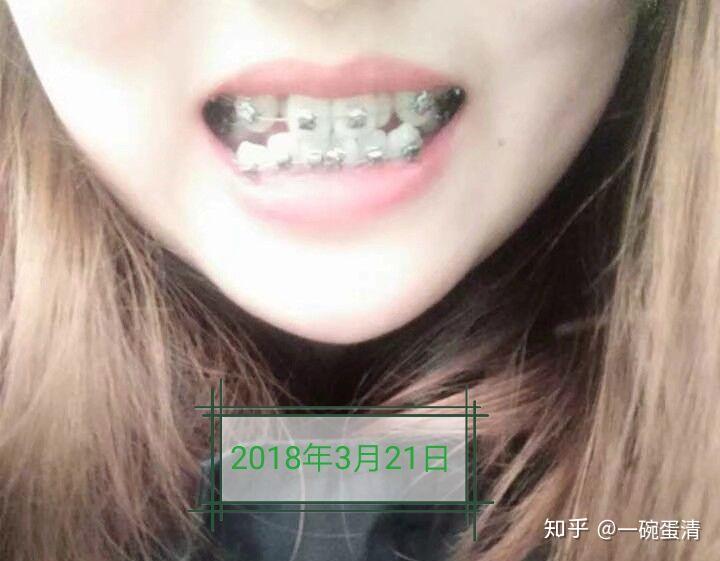 v2-e37e5d9cf52aacfa8bddc27a01a01a28_r.jpg