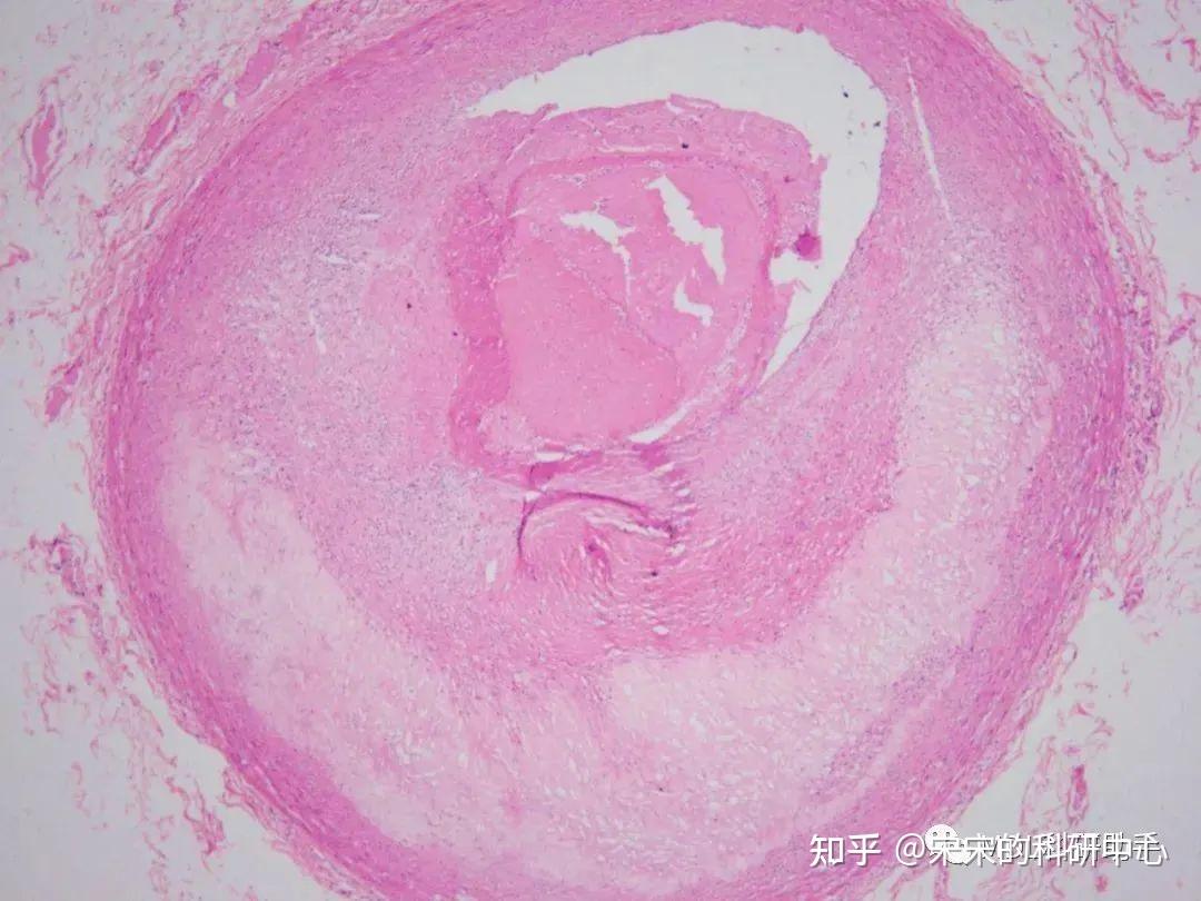 切片学习 | 常规病理组织切片及诊断要点 - 知乎